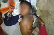 School cook allegedly throws hot dal on class 1 boy who asked for more